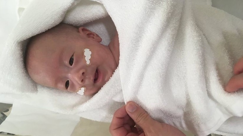 Sobrevive el bebé más pequeño del mundo, pesó 268 gramos al nacer