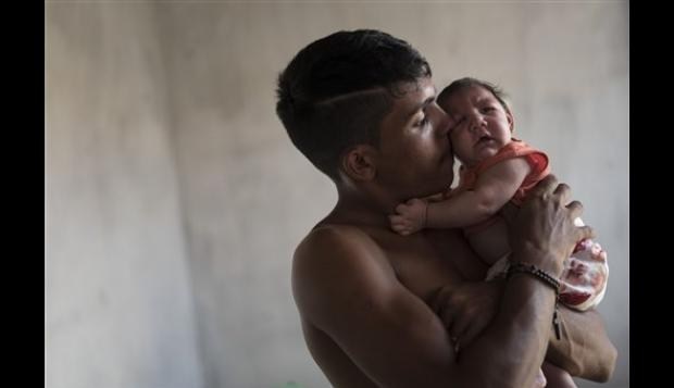 Brasil busca un nexo entre malformaciones y virus del zika