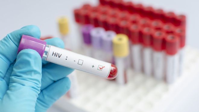 Científicos españoles logran eliminar el VIH en un paciente por segunda vez en la historia