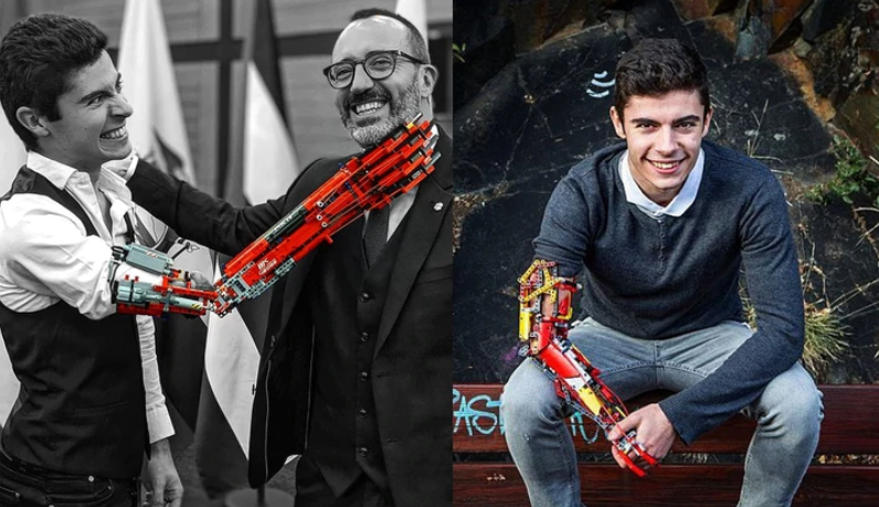 La impactante historia del joven que fabricó sus prótesis con Legos