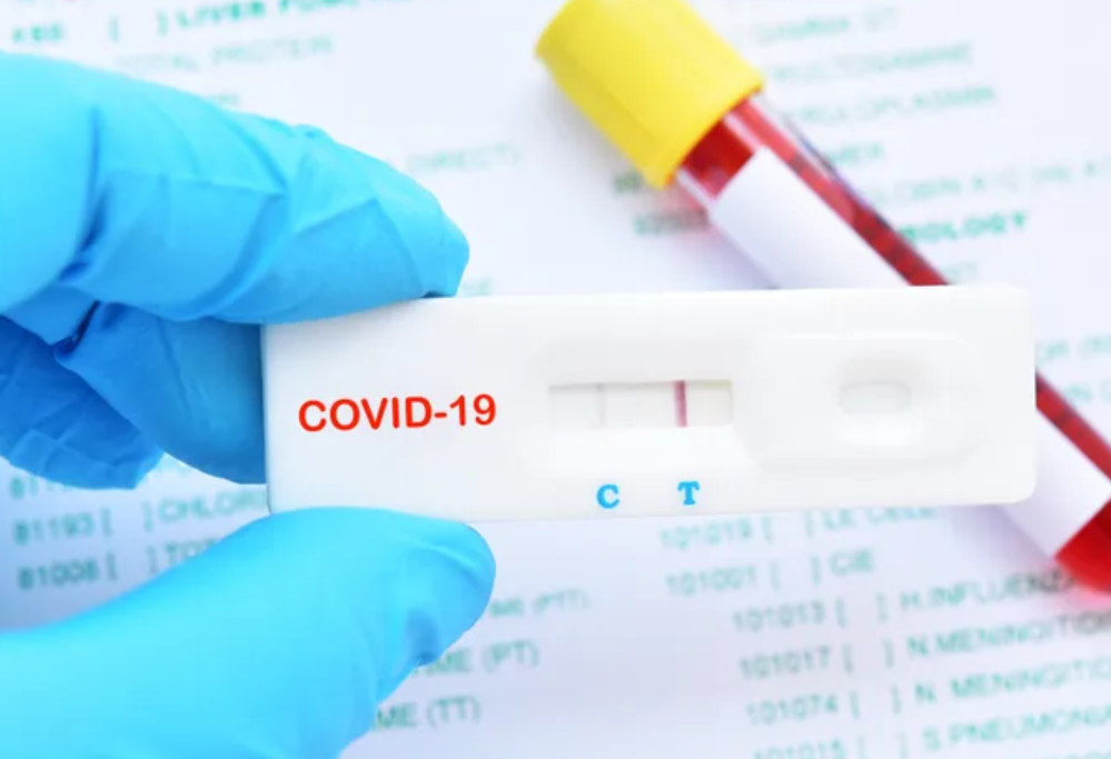 ¿Cómo funcionan los test rápidos del coronavirus?