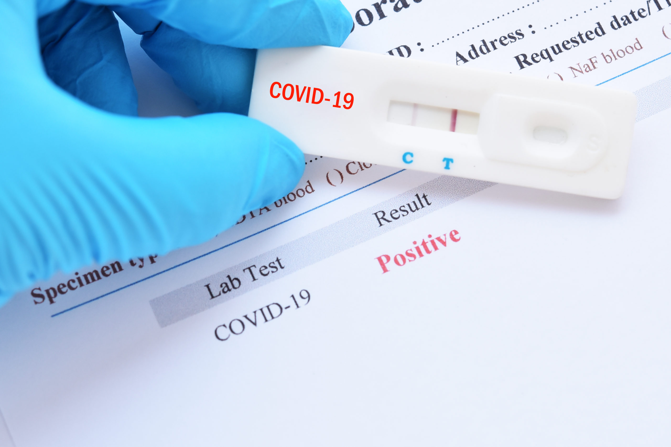Coronavirus en RD | 459 nuevos contagios y 6 muertes en 24 horas