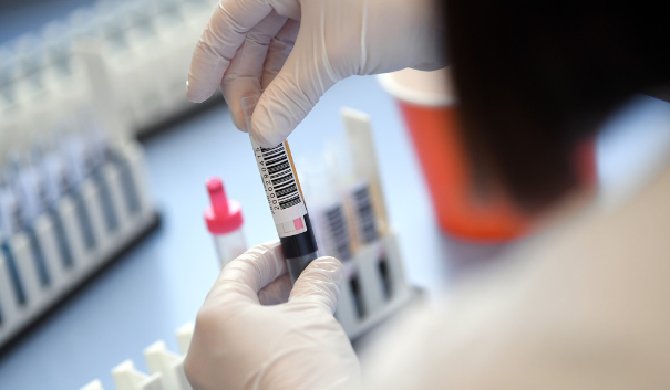 Laboratorio Nacional aún sin procesar pruebas PCR