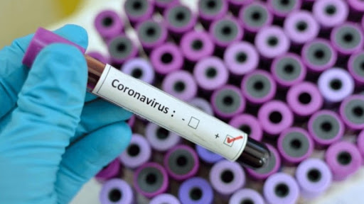 Coronavirus en RD | Se registran 13 muertos por COVID-19 en 24 horas