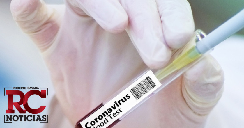 Coronavirus RD | 22 mueren por Covid-19 y 910 se infectan en 24 horas