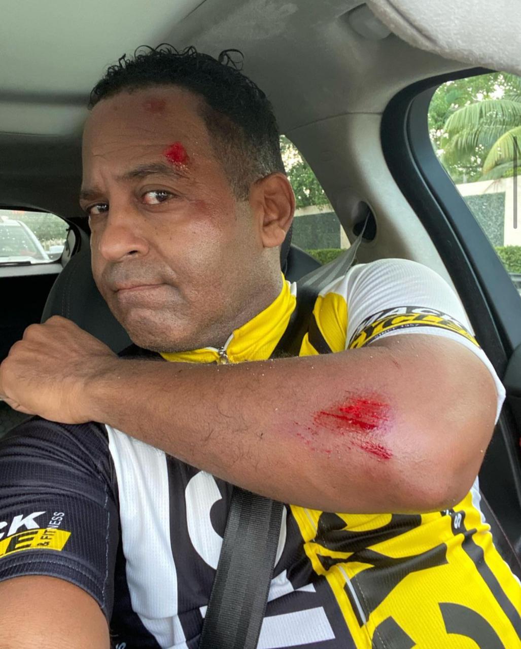 Tony Dandrades estable luego de accidentarse mientras realizaba ciclismo