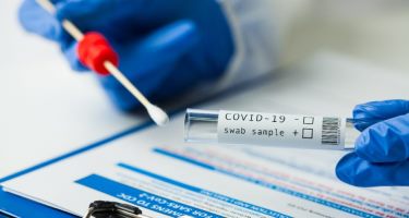 Coronavirus en RD | 855 contagios y 7 defunciones en las últimas 24 horas