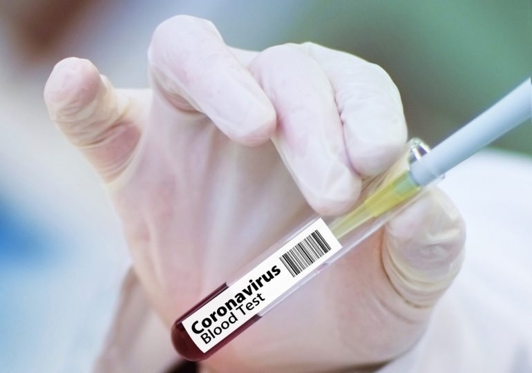Coronavirus RD | Reportan 746 de nuevos contagios y nueve decesos en las últimas 24 horas