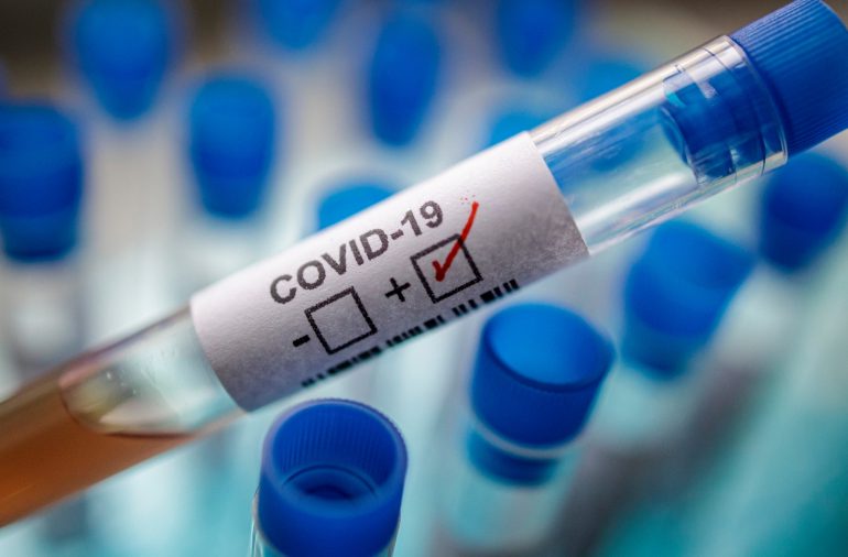 Coronavirus RD | Más de 2,900 muertes han sido reportadas durante la pandemia