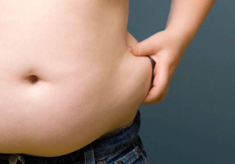 Personas que padecen obesidad corren doble de riesgo si contraen COVID-19