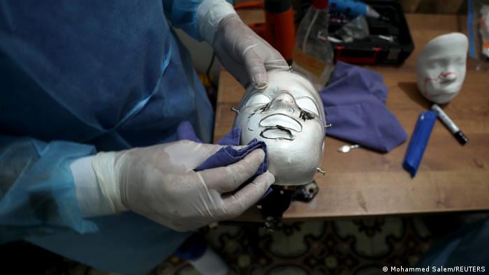 Máscaras impresas en 3D para curar rostros quemados en Gaza