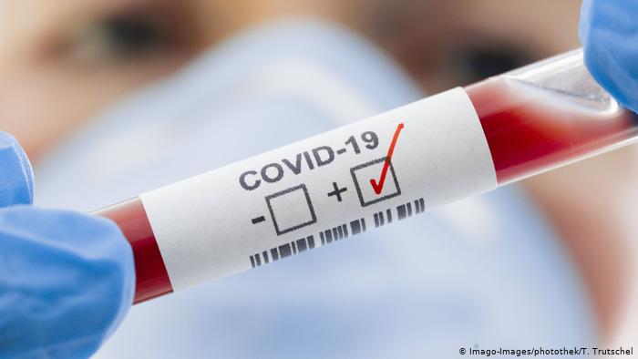 Coronavirus RD | Reportan 202 nuevos contagios y 10 defunciones en las últimas 24 horas