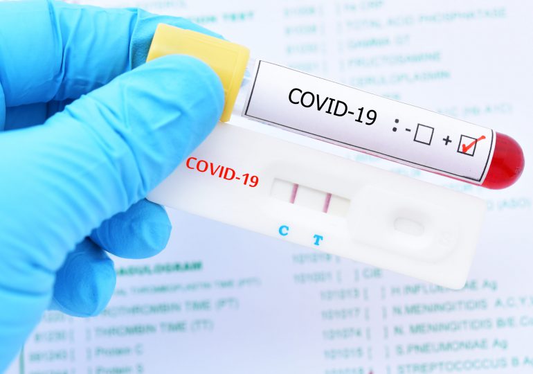 Coronavirus RD | Bajan los nuevos contagios y reportan un solo fallecido por covid-19