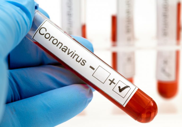 Coronavirus RD | Reportan nueve fallecidos por Covid19 y 429 nuevos contagios