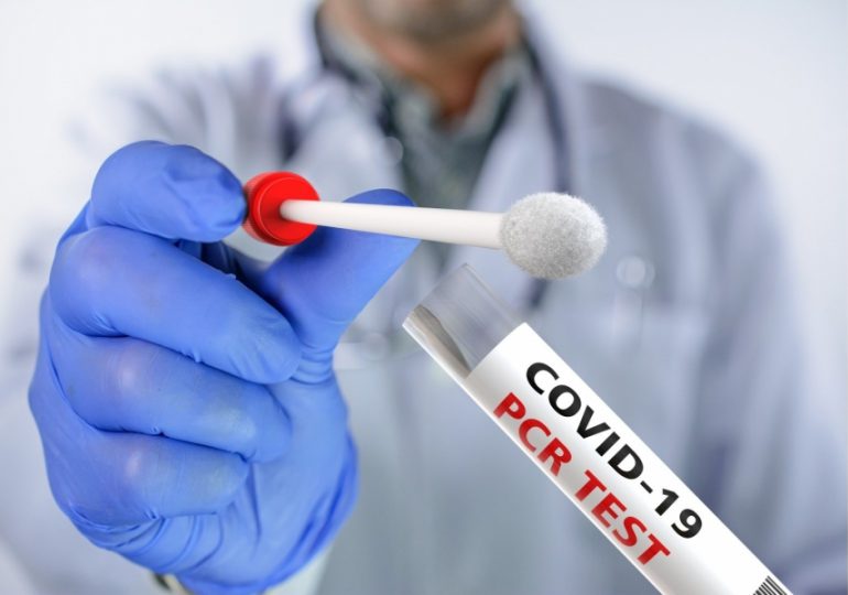 Coronavirus RD | 379 nuevos casos y tres decesos en las últimas 24 horas