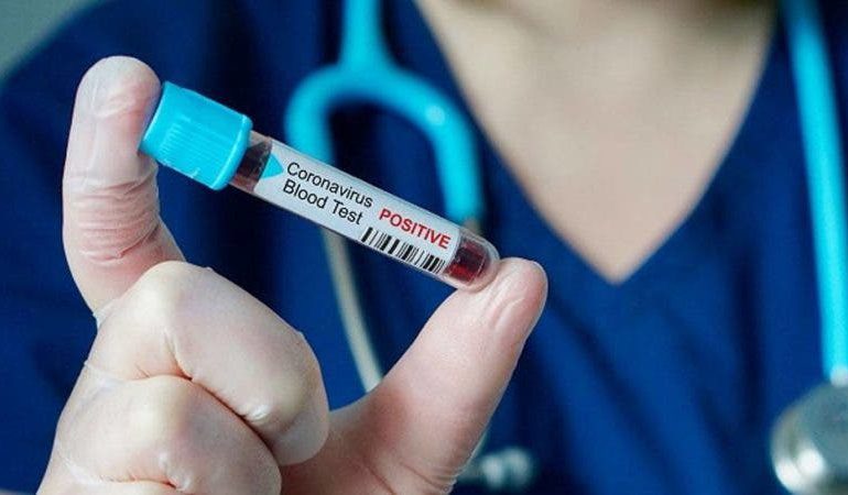 Coronavirus RD | 535 nuevos contagios y siete decesos en las últimas 24 horas