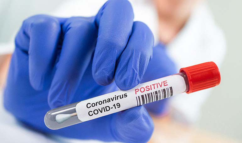Coronavirus RD | Reportan 642 nuevos casos y seis muertes en las últimas 24 horas