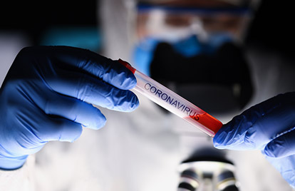 Coronavirus RD | MSP reporta 158 nuevos casos sin decesos