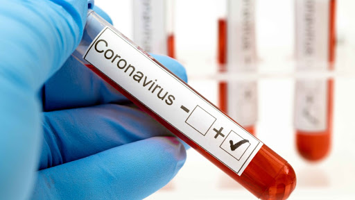 Coronavirus RD | Reportan 628 nuevos contagios, tres muertes y 49% ocupación camas UCI