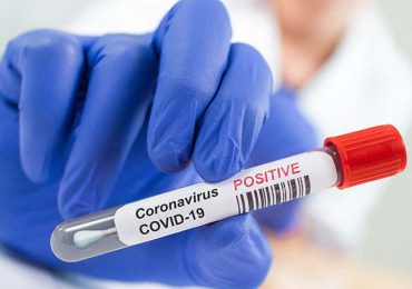 Coronavirus RD | Reportan 156 nuevos casos y un deceso en las últimas 24 horas