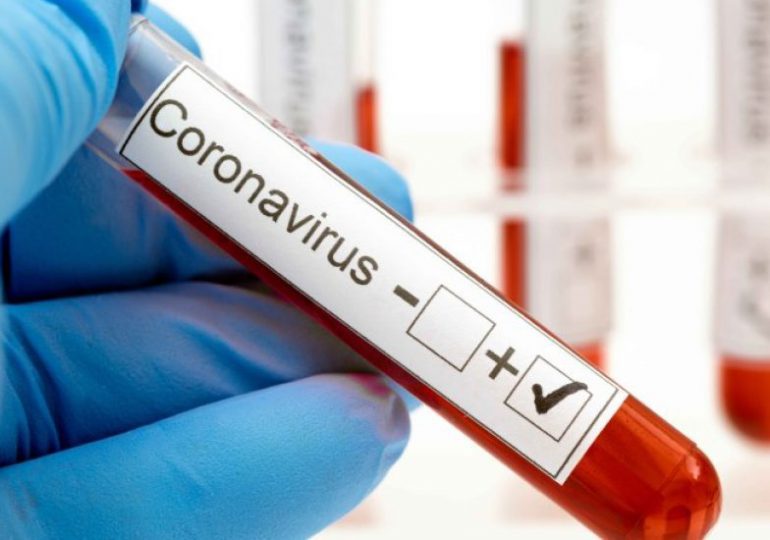 Coronavirus RD | Salud Pública reporta una defunción y 215 casos nuevos