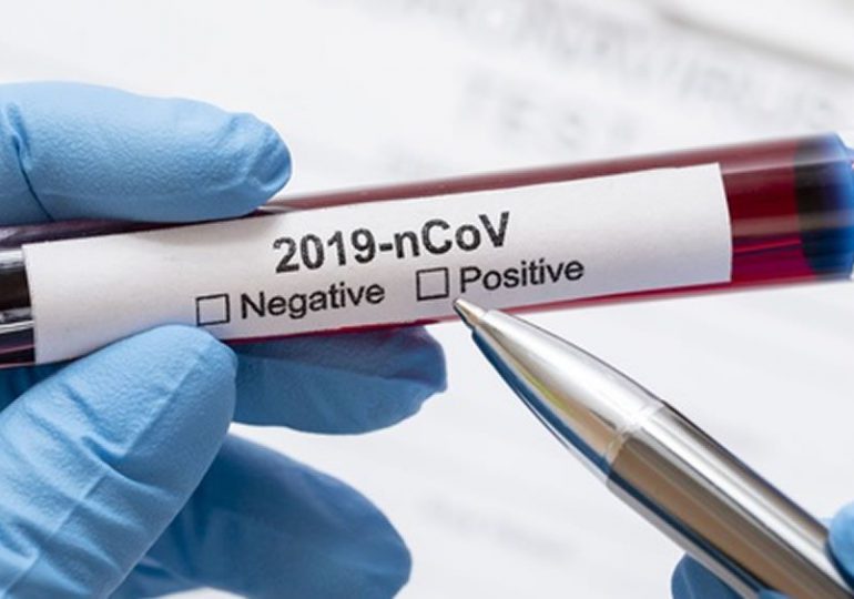 Coronavirus RD | MSP reporta 889  nuevos casos y  dos defunciones