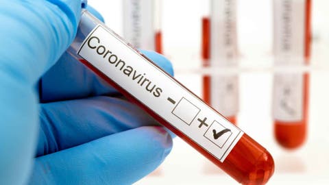 Coronavirus RD | Salud Pública reporta 115 nuevos casos y un fallecimiento