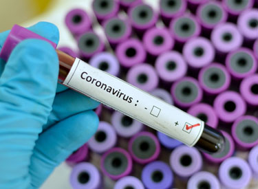 Coronavirus RD | Reportan 870 nuevos casos de y dos fallecimientos