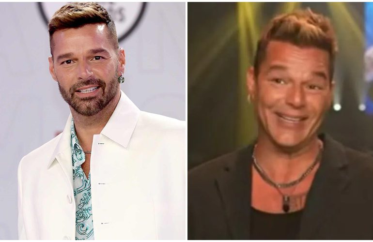 Ricky Martin despeja dudas sobre si se hizo o no un retoque en la cara