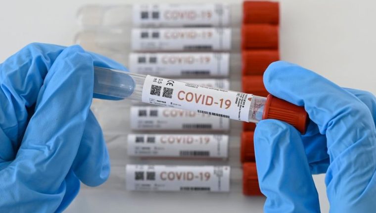 Coronavirus RD | MSP notifica cuatro defunciones y 707 casos nuevos