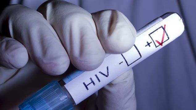 Tras años de investigaciones, sigue sin aparecer la vacuna contra el sida