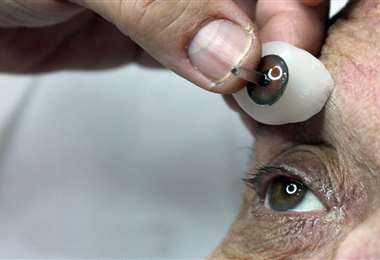 Un londinense recibirá una prótesis ocular impresa en 3D, una primicia mundial