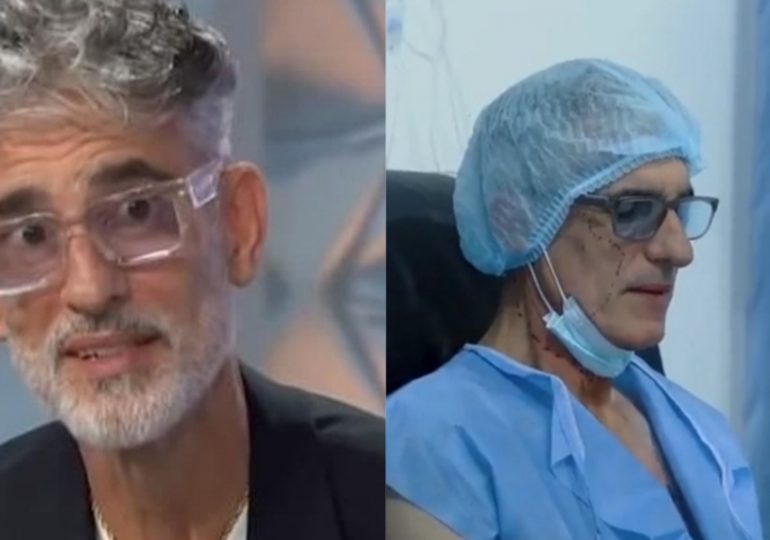 Vídeo| Actor Miguel Varoni se somete a cirujía plástica, desea parecerse a Maluma