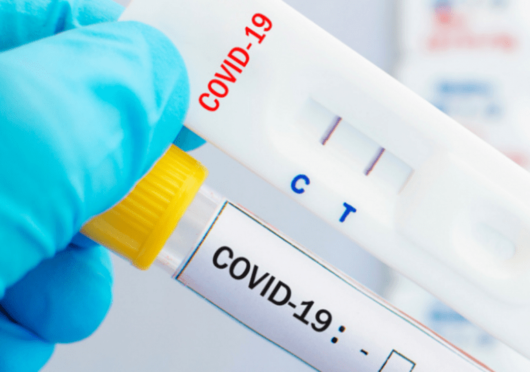 Gobierno permite la venta  libre de pruebas antígeno del Covid-19; farmacias las expedirán