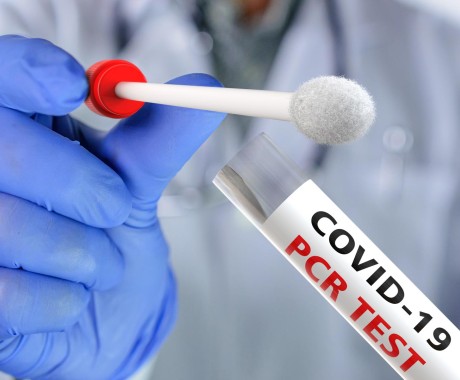 Coronavirus RD | Salud Pública reporta 30 nuevos contagios sin decesos en las últimas 24 horas
