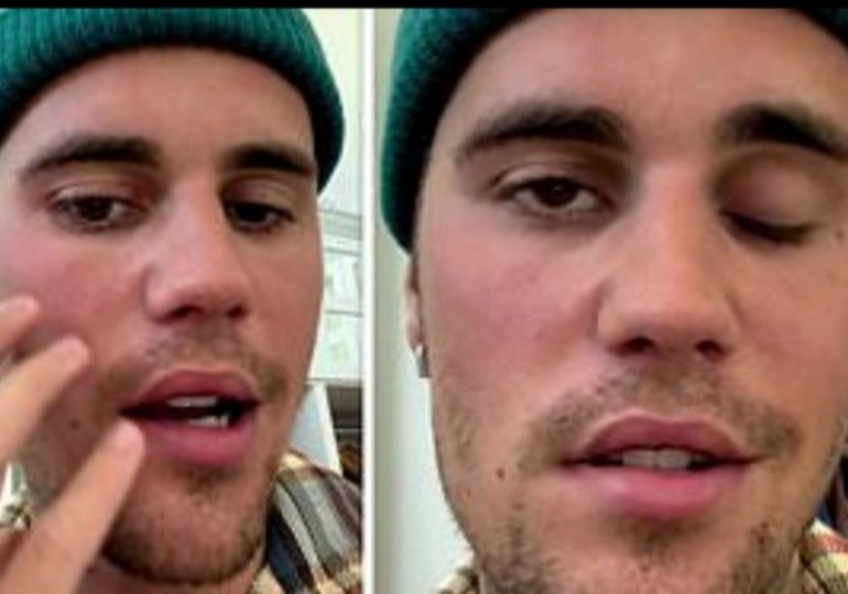Vídeo| Justin Bieber revela que padece parálisis facial a causa del síndrome de Ramsay Hunt