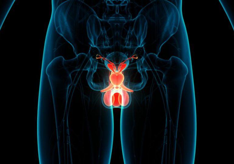 Alrededor del 50% de pacientes con cáncer de próstata nunca han visitado un urólogo