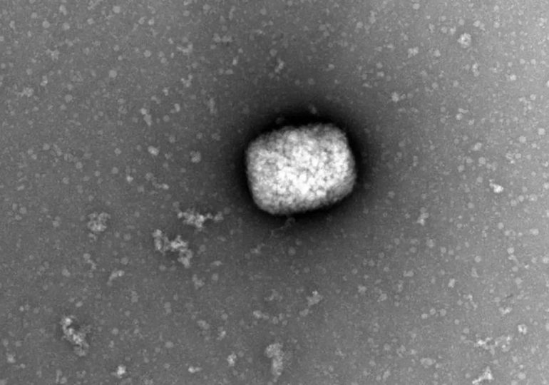 Expertos italianos sostienen que "no es raro" hallar el virus de la viruela del mono en el semen