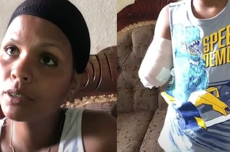 Mujer denuncia que a su hermano de 12 años le amputaron el brazo sin explicación