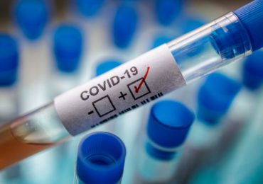 Sociedad de Infectología no considera alarmante aumento de casos Covid-19