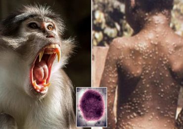 OMS pide respuesta "urgente" de Europa ante aumento de casos de viruela del mono