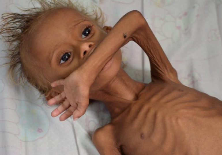 Una persona muere de hambre en el mundo cada cuatro segundos, denuncian oenegés