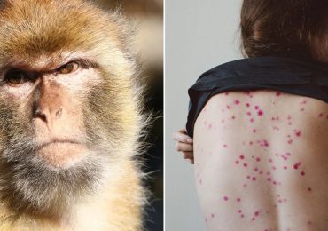 China registra su primer caso de viruela del mono