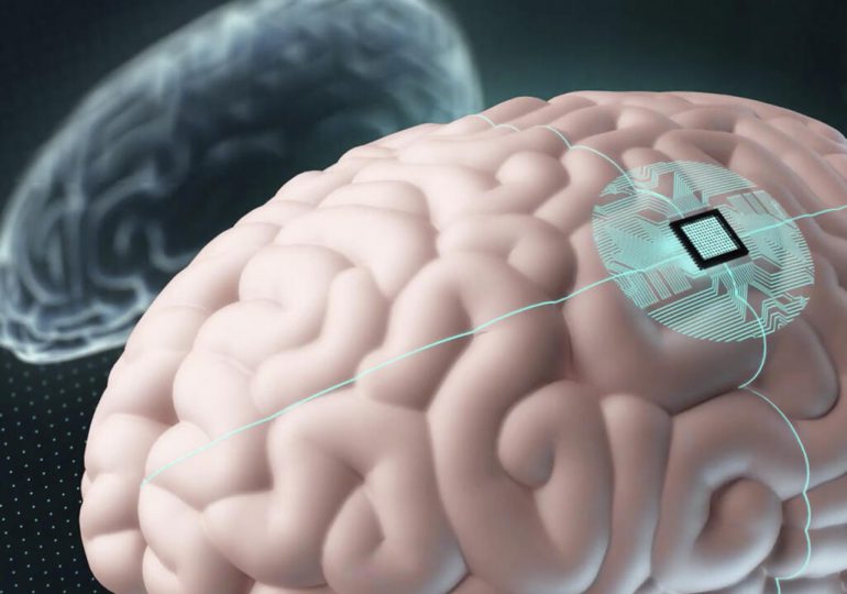 Crean un implante para destruir tumores alojados en el cerebro