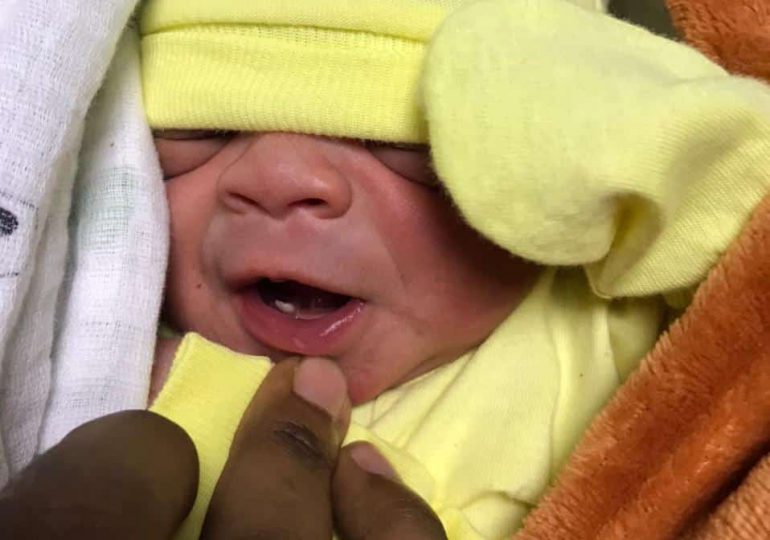 Nace niño con un diente en hospital de Cotuí