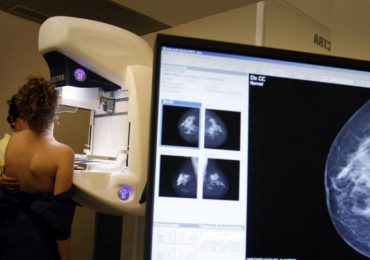 Pacientes con cáncer de mama metastásico pueden mejorar su expectativa de vida con medicamentos innovadores