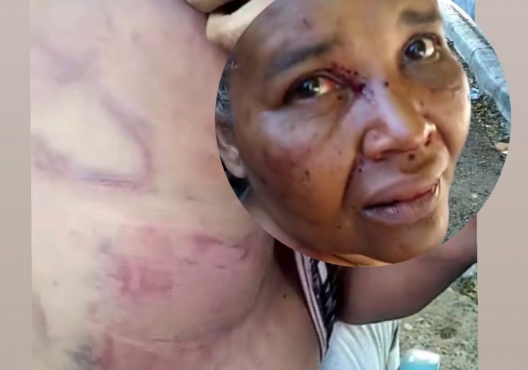 Video| Mujer en Azua recibe “golpiza” a manos de su ex pareja quien está en libertad