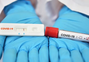 Reportan 252 nuevos casos de COVID-19 y mantiene baja ocupación hospitalaria