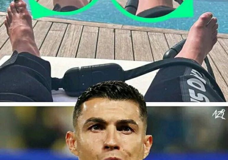 El estado de los pies de Cristiano Ronaldo deja a todos sorprendidos