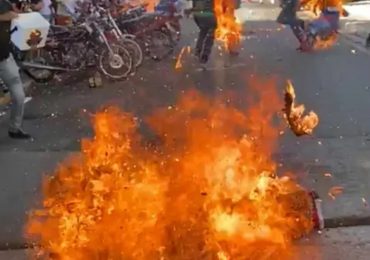 Fallece último niño ingresado en unidad de quemados en Santiago por fuego en carnaval de Salcedo